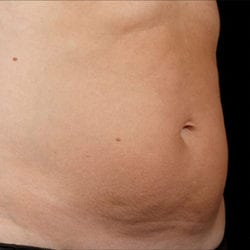 sculpture-case-8-after-jpg