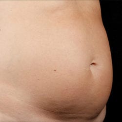 sculpture-case-8-before-jpg