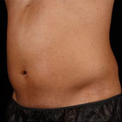 sculpture-case-9-after-jpg