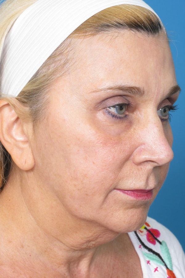 sutoquarteraedit-jpg