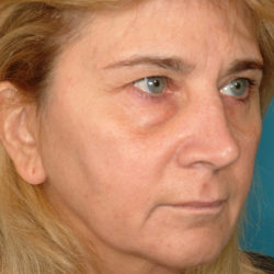 sutoquarterbedit-jpg