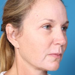 vidaquarteraedit-1-jpg