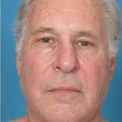 case4-after-e1483735458939-jpg