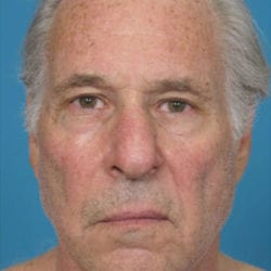 case4-e1483735446970-jpg