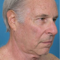 case4side-e1483771176776-jpg