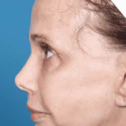 dmmd-dr-daniel-man-doplside2-copy-png