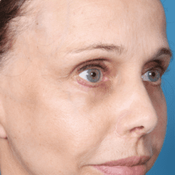 dmmd-dr-daniel-man-doplside3-png