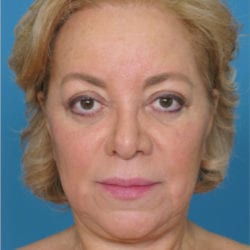 ear-dr-daniel-man-micefront-jpg