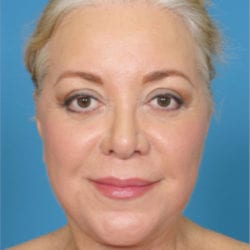 ear-dr-daniel-man-micefront-copy-jpg