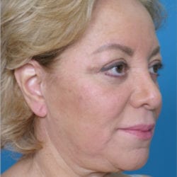 ear-dr-daniel-man-miceside2-jpg