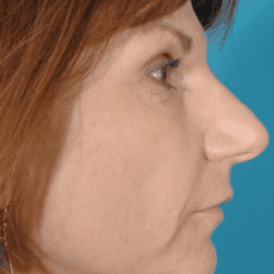 neurotoxin-dr-daniel-man-neside2-copy-e1483724448356-png