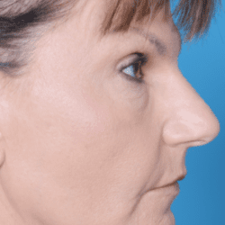 neurotoxin-dr-daniel-man-neside2-e1483724467225-png