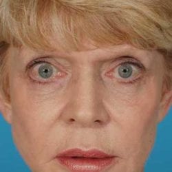 neurotoxins-dr-daniel-man-cdfront1-jpg