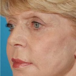 neurotoxins-dr-daniel-man-cdside1-jpg