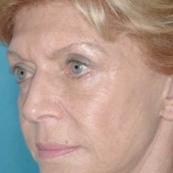 neurotoxins-dr-daniel-man-cdside1-copy-jpg