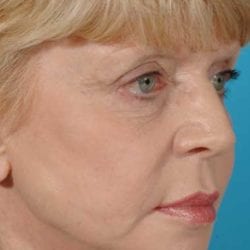 neurotoxins-dr-daniel-man-cdside2-jpg