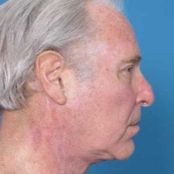 ralf-dr-daniel-man-jfside1-jpg