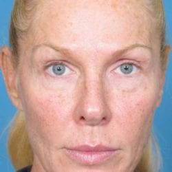 refit-dr-daniel-man-kastfront-copy-jpg