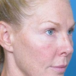 refit-dr-daniel-man-ksside1-copy-jpg