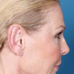 refit-dr-daniel-man-ksside2-jpg