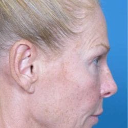 refit-dr-daniel-man-ksside2-copy-jpg