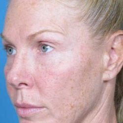 refit-dr-daniel-man-ksside3-copy-jpg