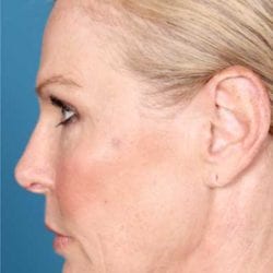 refit-dr-daniel-man-ksside4-jpg