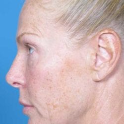 refit-dr-daniel-man-ksside4-copy-jpg