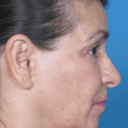 refit-dr-daniel-man-lhside1-copy-e1483771067222-png