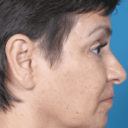 refit-dr-daniel-man-lhside1-e1483771075238-png