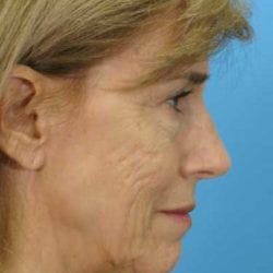 srp-dr-daniel-man-mzlside2-jpg