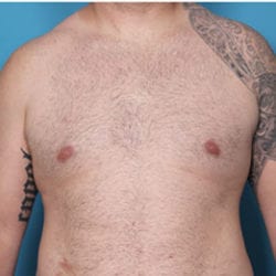 thguy-front1after-jpg