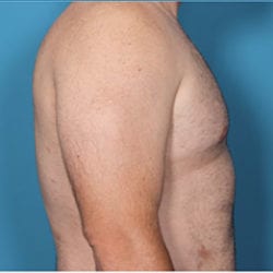 thguy-side1after-jpg