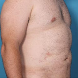 thguy-side2after-jpg