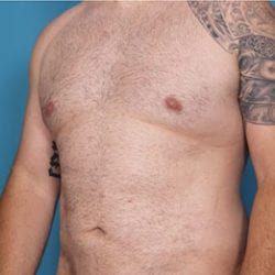 thguy-side3after-jpg